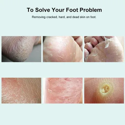 משייף ציפורניים מקצועי (פצירה) דו-צדדית – לעיצוב, החלקה וגימור מושלם